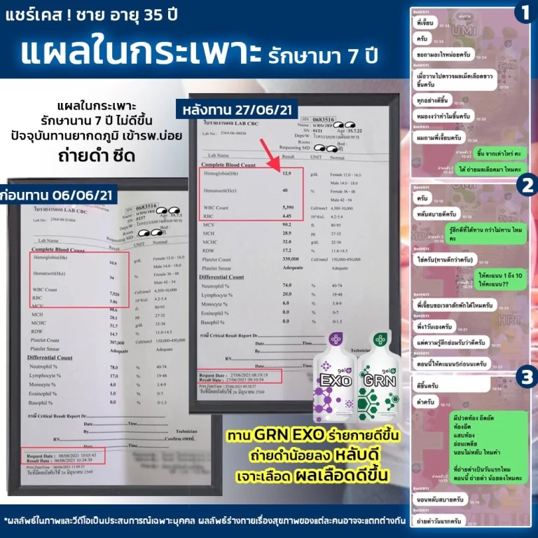 S__40722628-copy-768x768-1 EXO : ผิวใส ต้านอนุมูลอิสระ ชะลอวัย