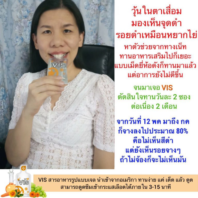 VIS_Vitreous-degeneration-1 GelPlus VIS : บำรุงสายตา ลดตาเสื่อม ลดตาแห้ง